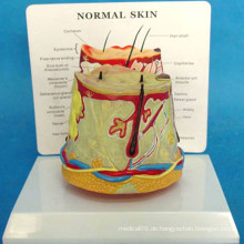 Pathologische menschliche Haut Medizinische Anatomie Modell für Demonstration